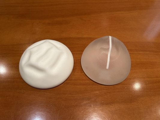 Revisión de implantes mamarios